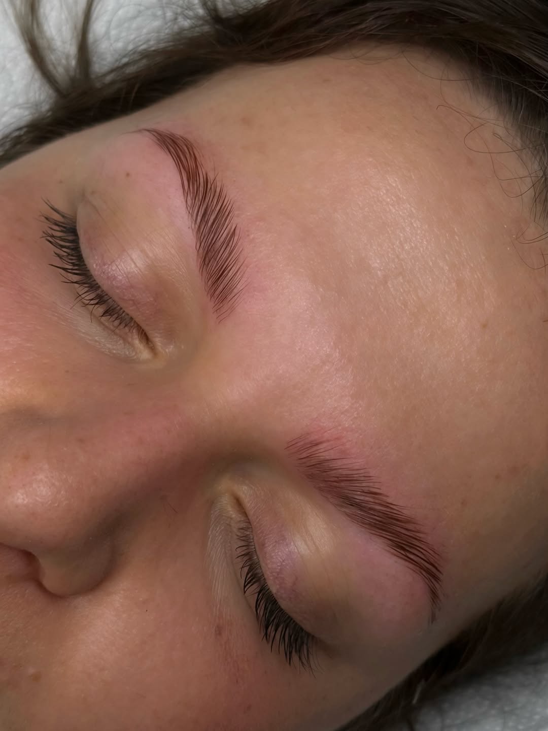 Réalisation Browlift